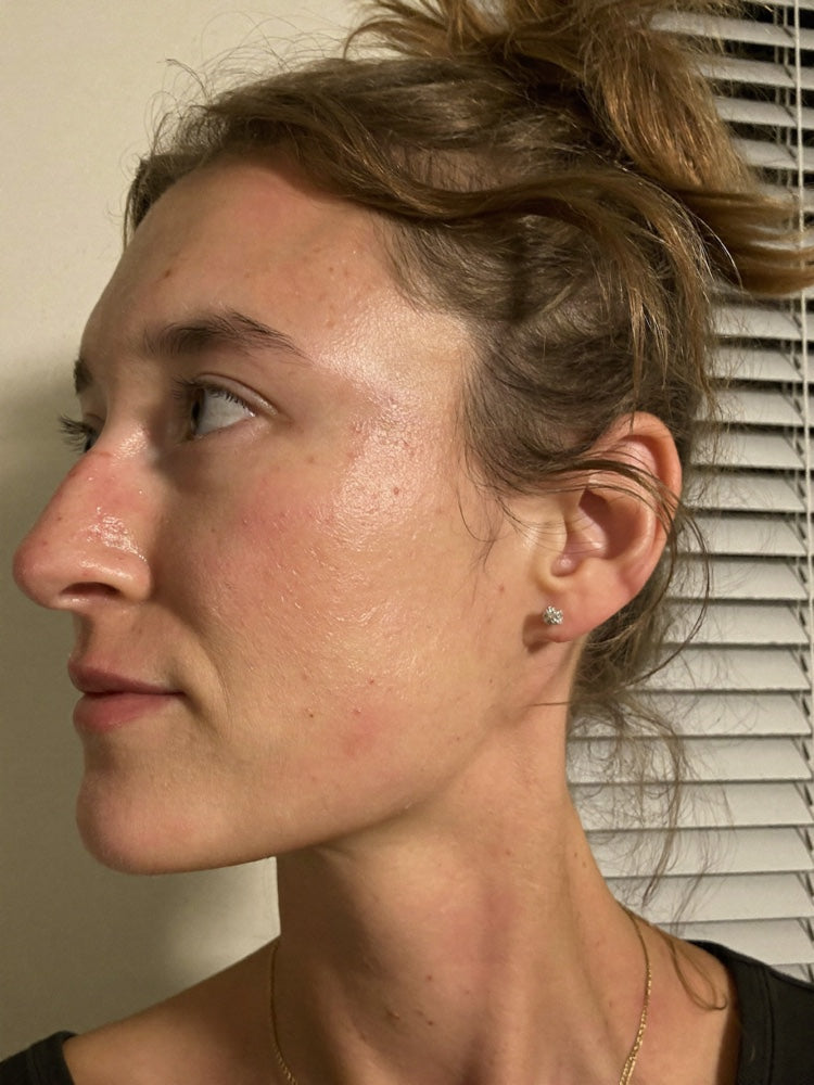 Side profile of a woman, before photo