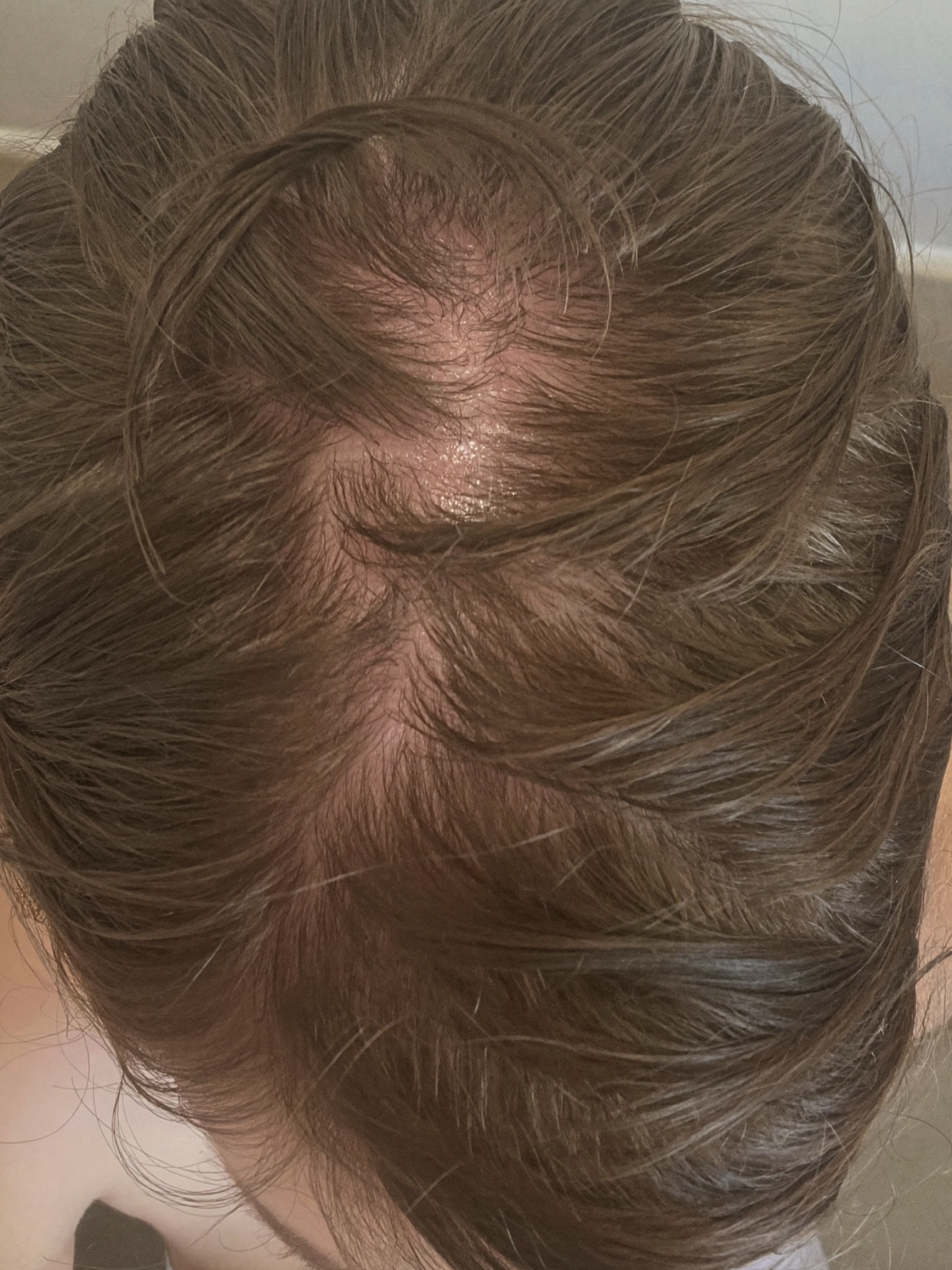 Close-up of the crown and hair part
