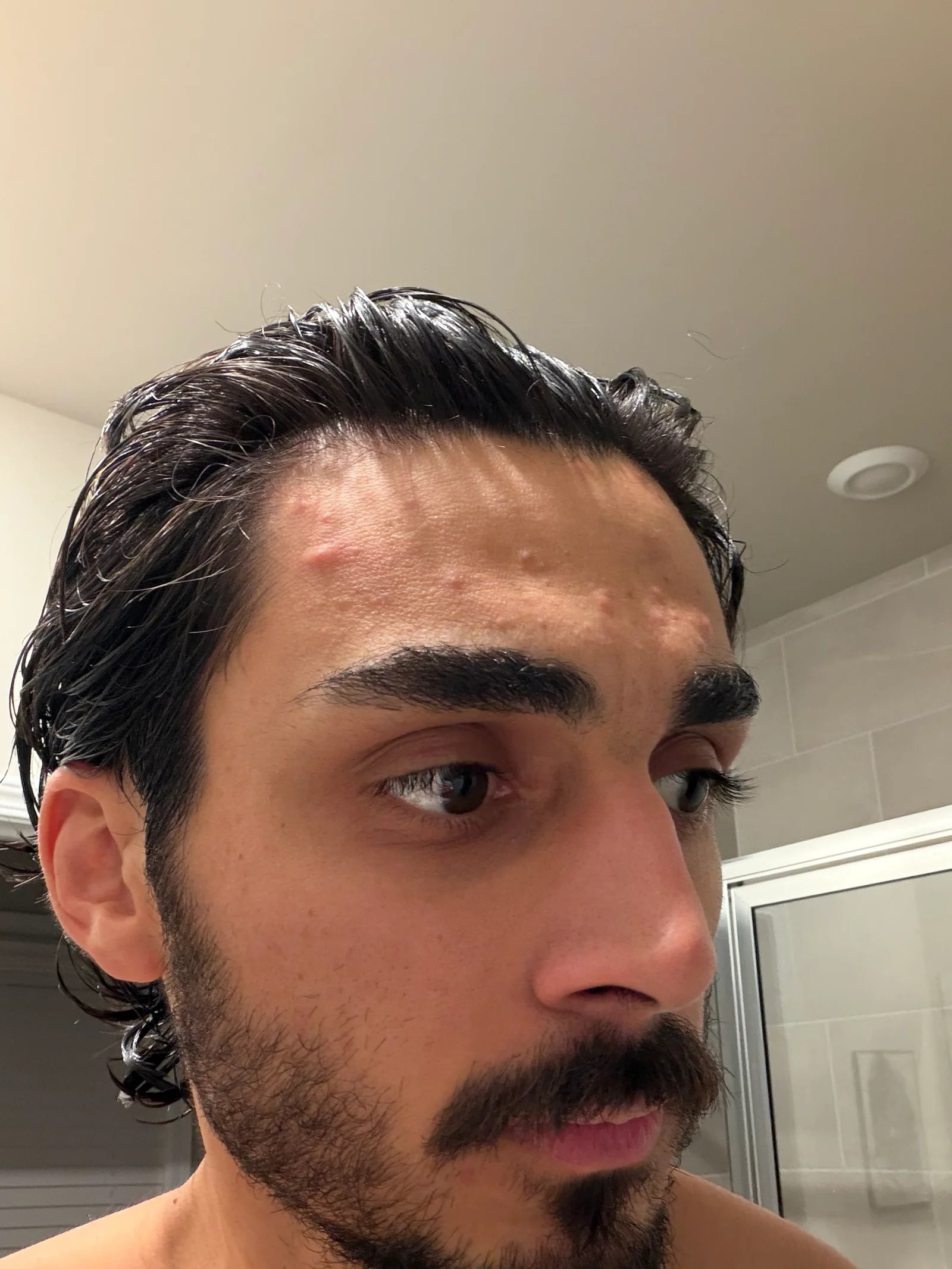 Before image